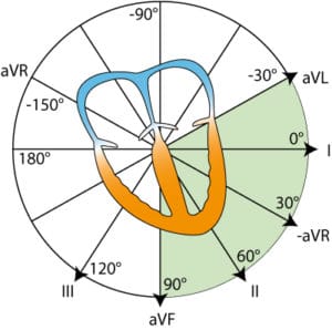 لید aVR- و سیستم نمایش کابررا